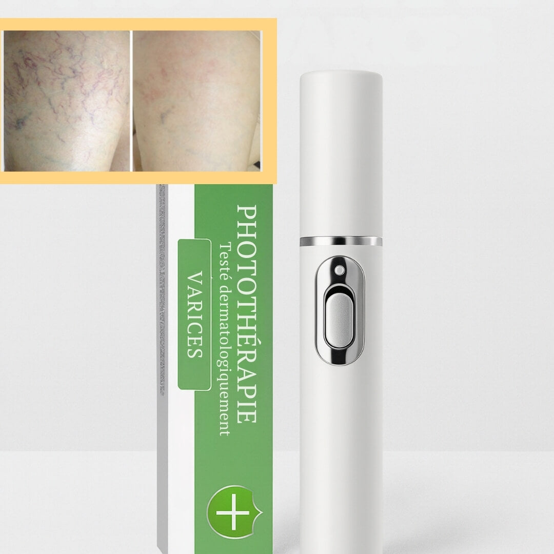 VarixCare Laser® – Traitement des varices 3ᵉ génération