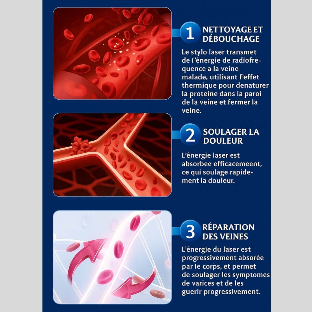 VarixCare Laser® – Traitement des varices 3ᵉ génération