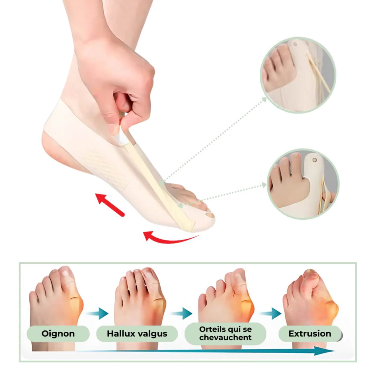 Chaussette Hallux Valgus Correctrices (Taille Universelle)